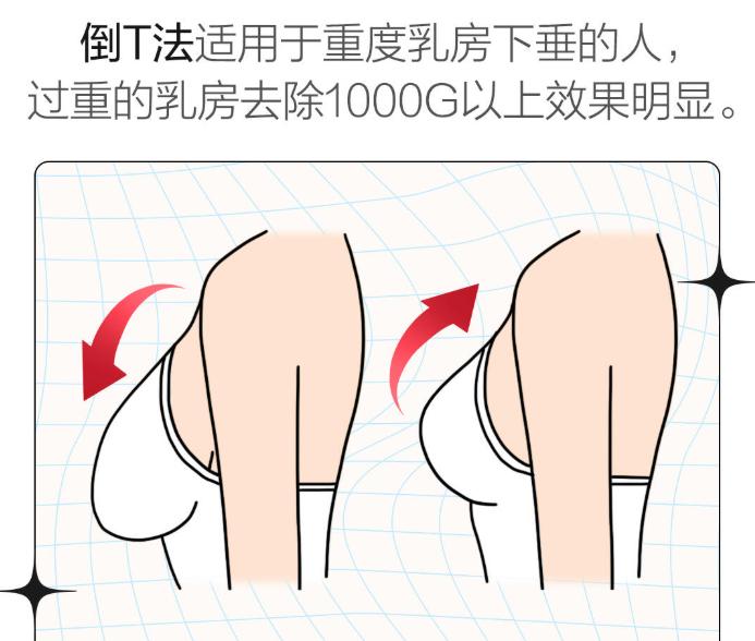 郑州赵绛波缩胸手术预约怕被坑？认准美卫士官方备案的绿色通道