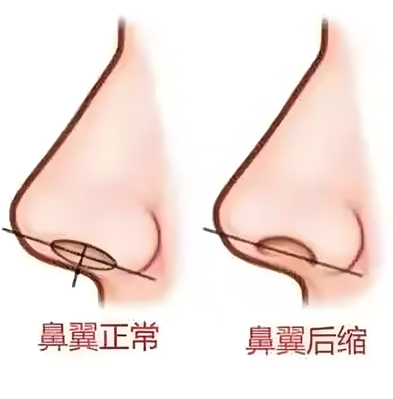 3. 依托有名的平台的医疗确保优势www.51aimei.com
