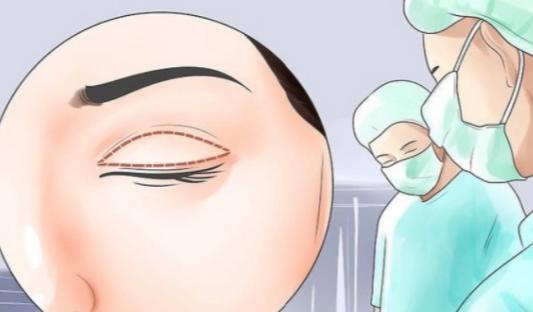 异地做眼修复大家都在问的硬核QA