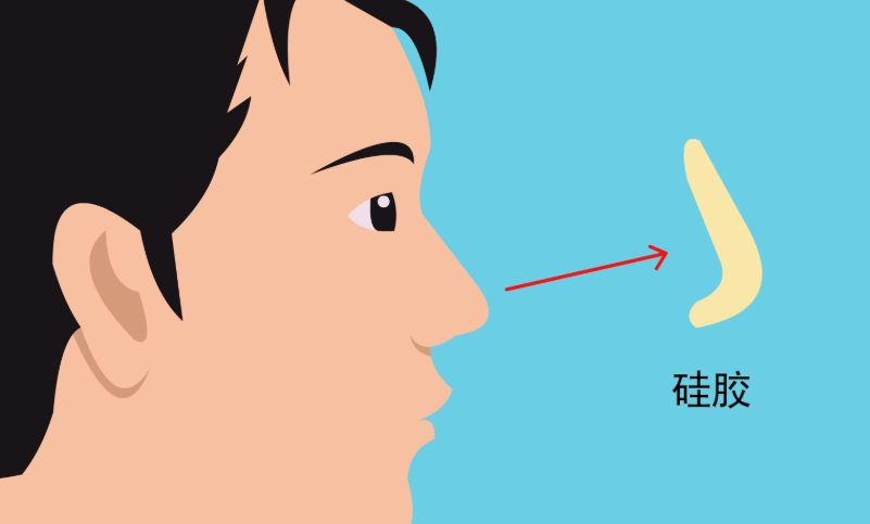 三、长沙秦晓东隆鼻预约挂号全流程图解与实操指南