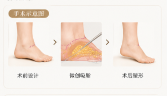 一、避坑首要:杭州易成刚医生的实力与“挂号难点”