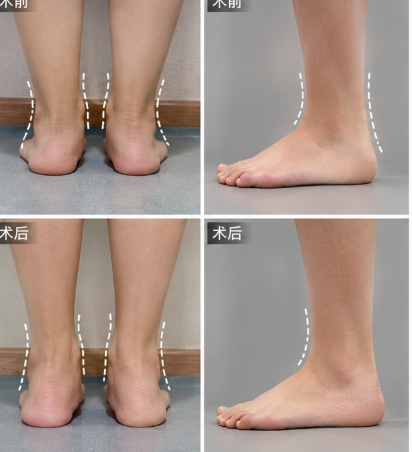 三、真实用户FAQ:面诊易成刚医生的那些“大实话”www.51aimei.com