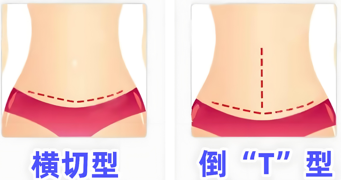 五、想找李献和医生得怎么走流程?这里有一份超接地气的预约攻略