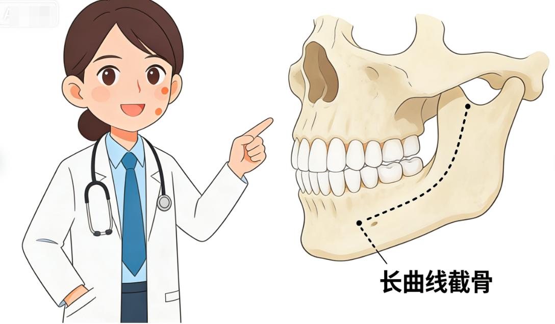 上海李志海医生好预约吗？想约他做下颌角/颧骨的趁早规划，美卫士查排期+绿色预约通道！