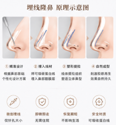 三、在重庆军科找林勇做歪鼻矫正要花多少钱?