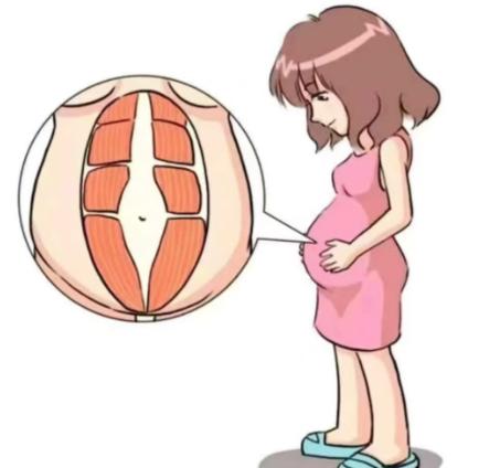 关于预约任杰医生做腹壁整形手术的其他热点QA