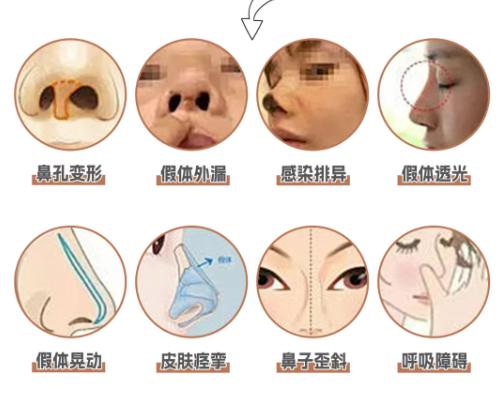 二、李保锴医生的技术方案与价格解析