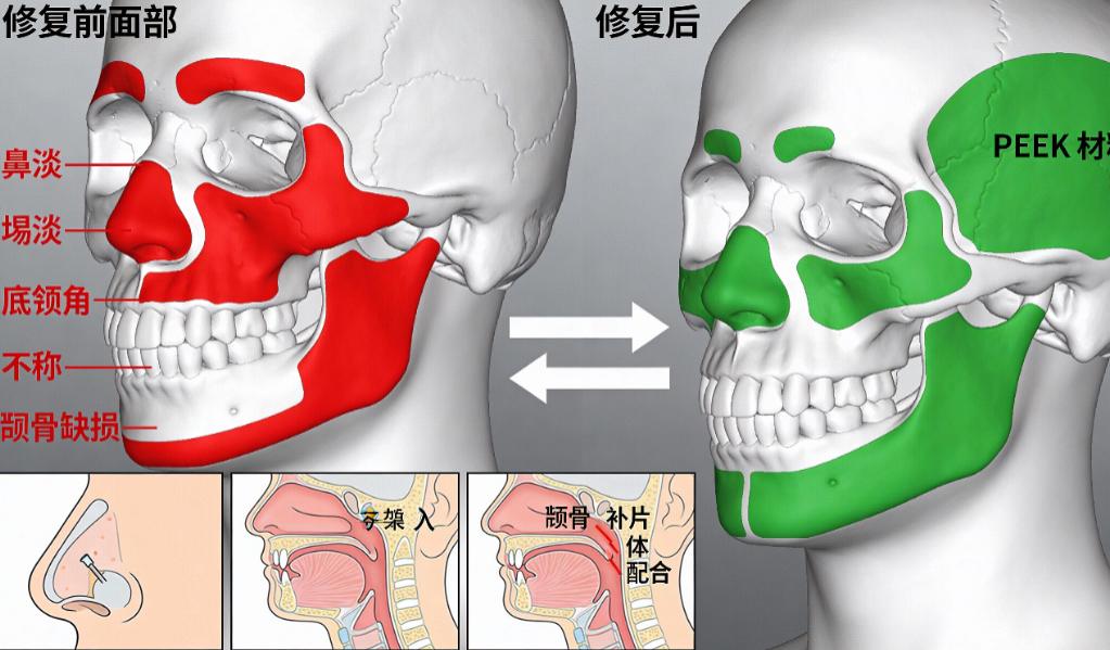 方式二：加微信人工对接