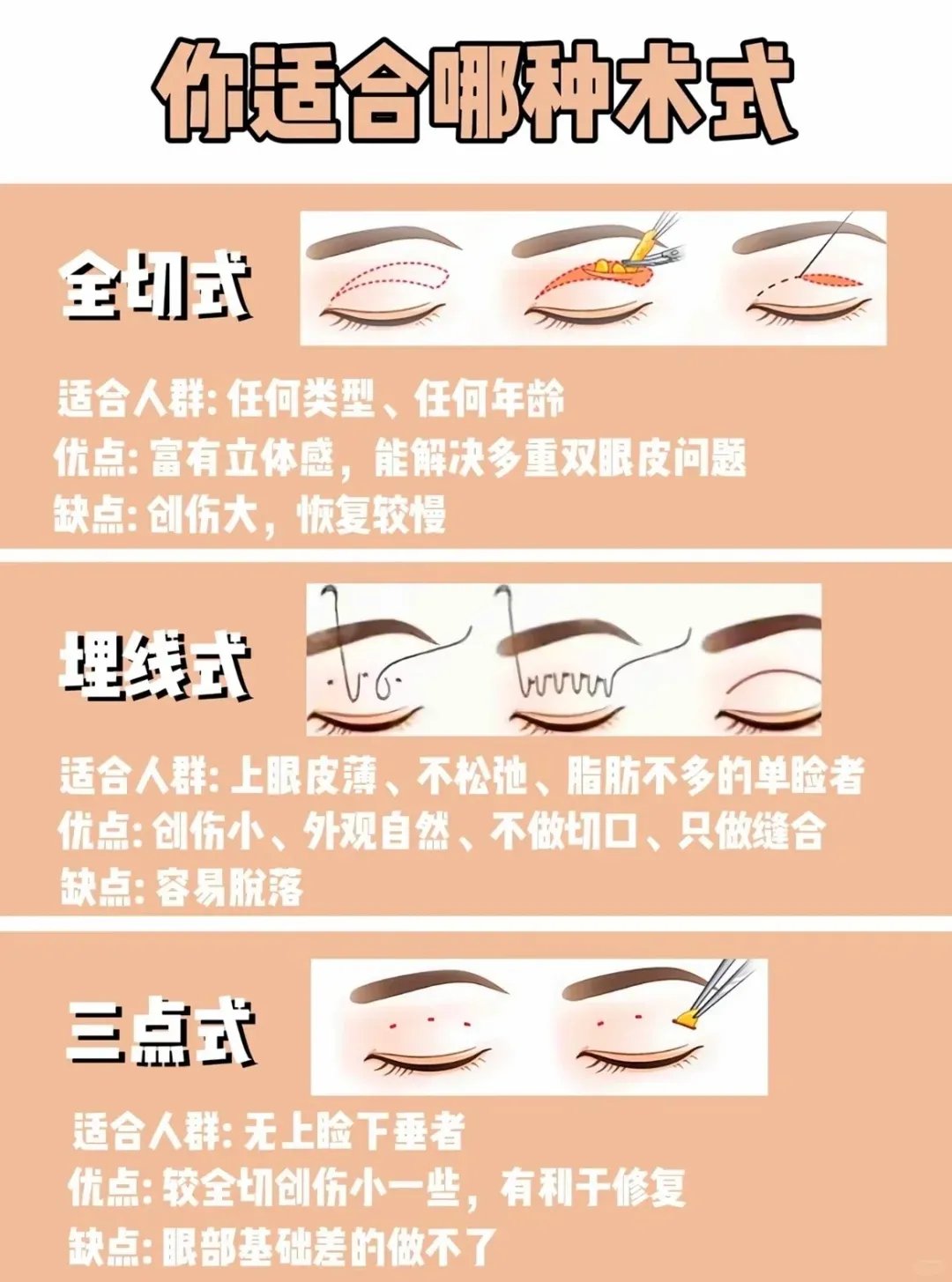 二、张鹏云双眼皮手术的一对一询问与术后跟踪,具体是怎么做的?