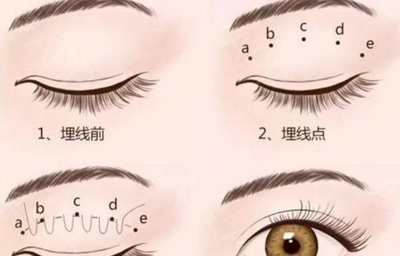 3. 医患沟通与方案设计www.51aimei.com