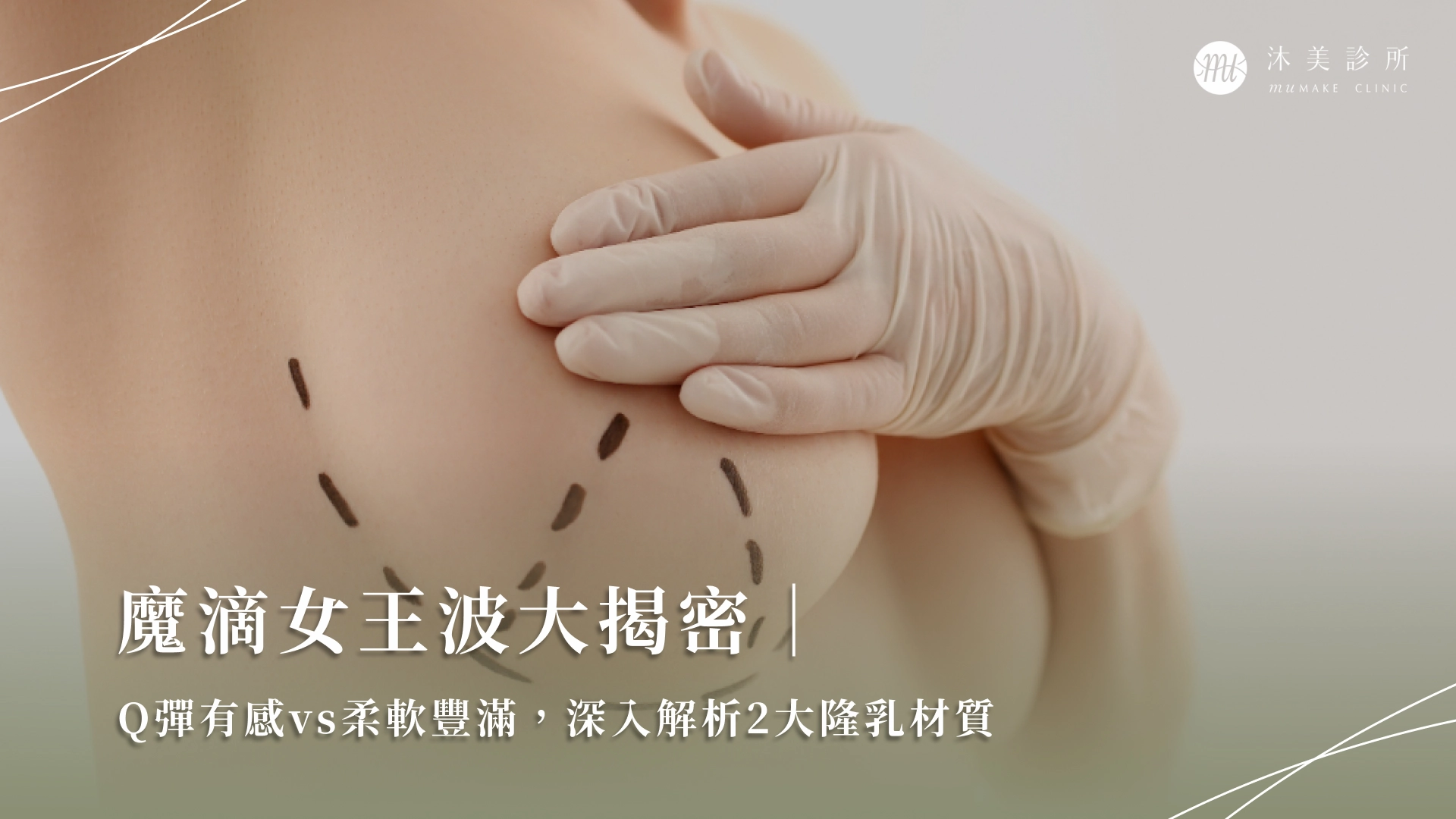 临床上唐毅如何通过科学手段确保假体不发生移位与硬化？