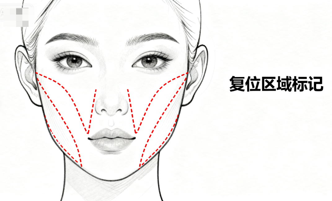 一、长沙谭龙柯筋膜提升价格:一份详细的“费用构成清单”