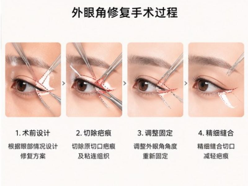 五、FAQ:关于肖文明眼修复的热门问题