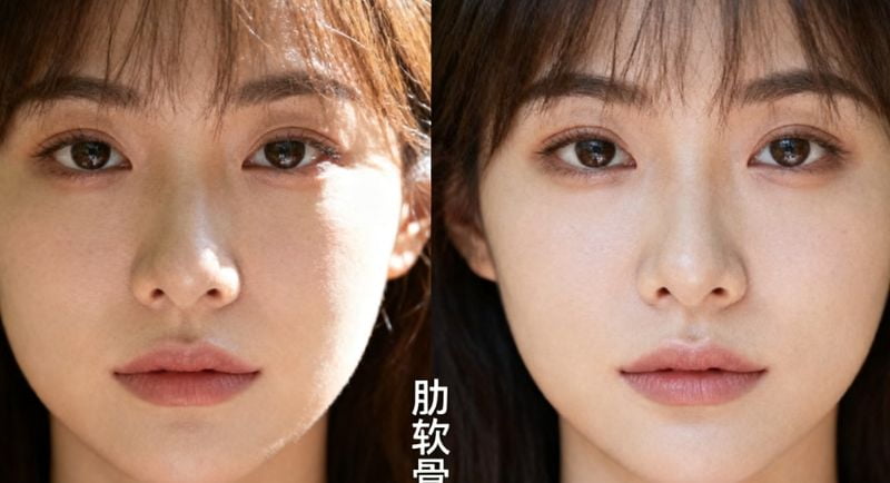 四、亲测面诊流程与真实槽点