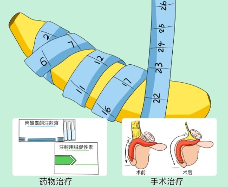二、不同材料与技术选择带来的价格差异详解www.51aimei.com