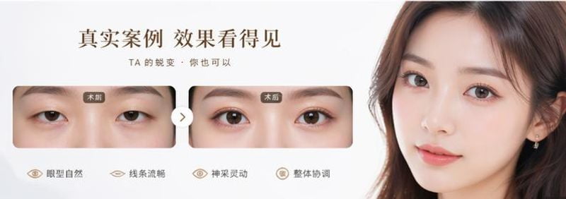 避坑指南:通过“美卫士”平台预约挂号杭州艺星杨连华完整流程