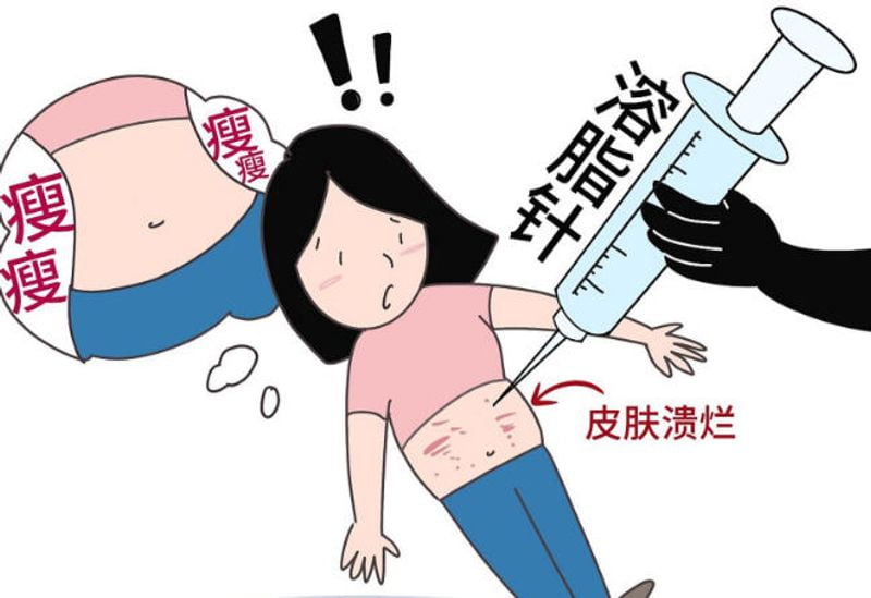 华美何斌吸脂填充价格贵不贵？腰腹环吸、大腿抽脂、面部黄金微雕价格差挺大