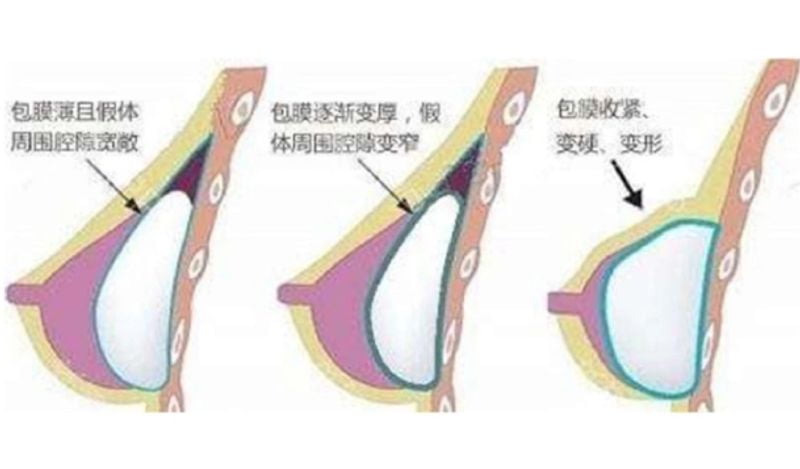 www.51aimei.com