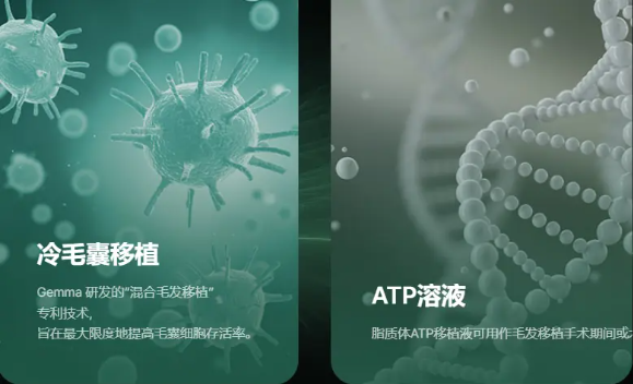 首尔gemma 植发中心技术