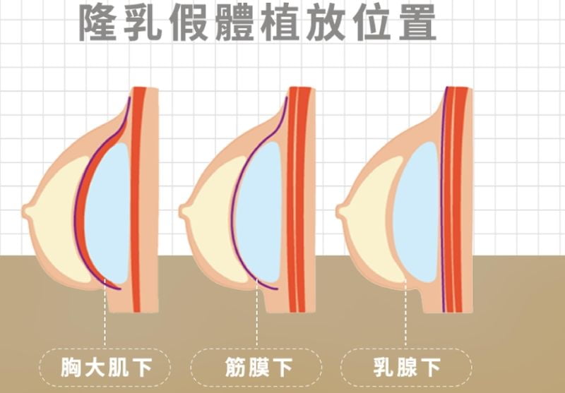 二、赵敬国医生的专门背景与擅长领域是什么？www.51aimei.com