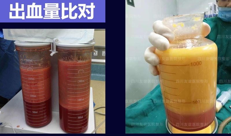 五、常见问题解答 (FQA)