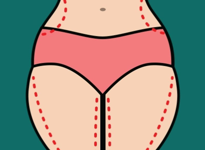 姐妹们都在扒：刘李娜医生擅长脂肪塑形吗？美卫士真实反馈：懂幼态脸审美、脂肪取量精准、不盲目多填