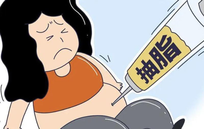 五、关于陈孝闯吸脂直腿术的常见问题解答（FQA）