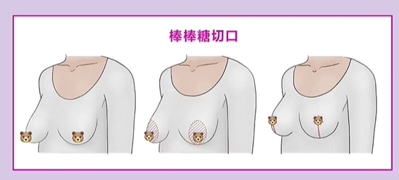 三、价格贵不贵?面诊流程和排班到底怎么查?