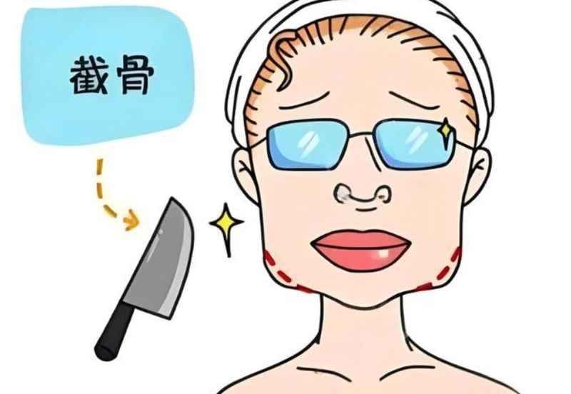 徐威强磨骨在国内出名吗？当然有名！真实评价告诉你他为什么在轮廓届口碑这么稳