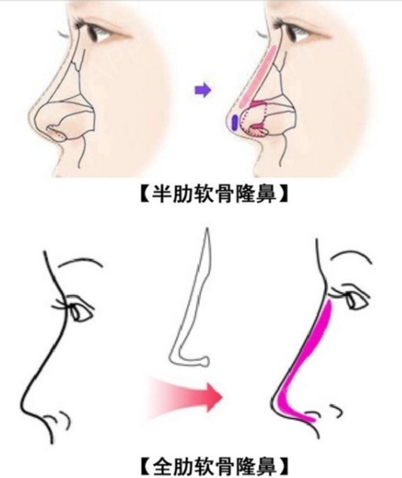 真实用户提问与互动(FQA)www.51aimei.com