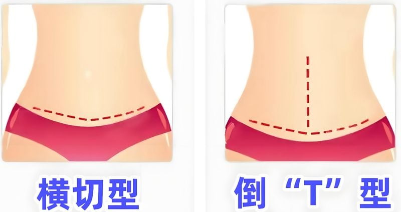 www.51aimei.com