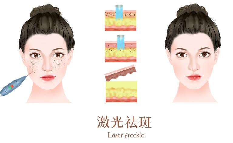 5. 设备能不能当面扫码验真?
