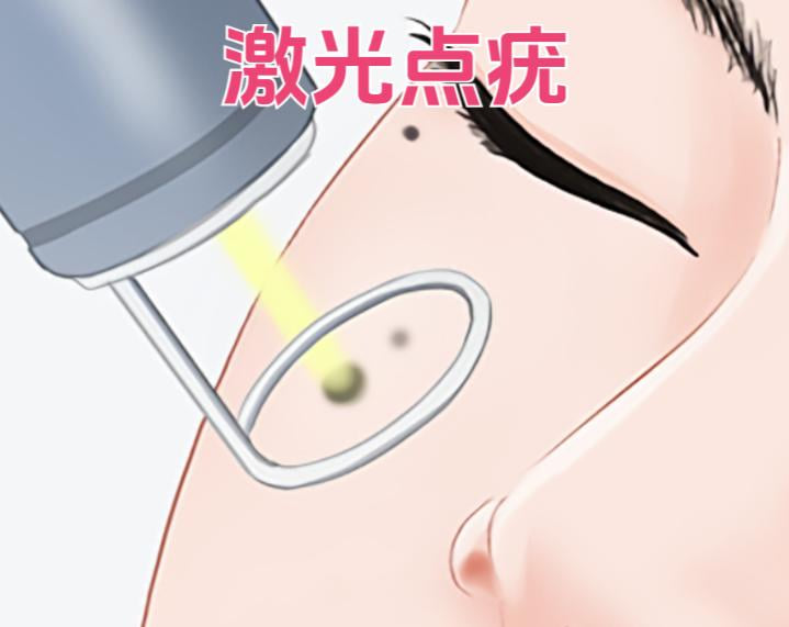 方式二:美卫士APP