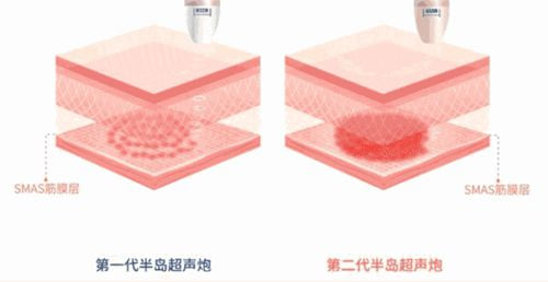 四、常见问题Q&A