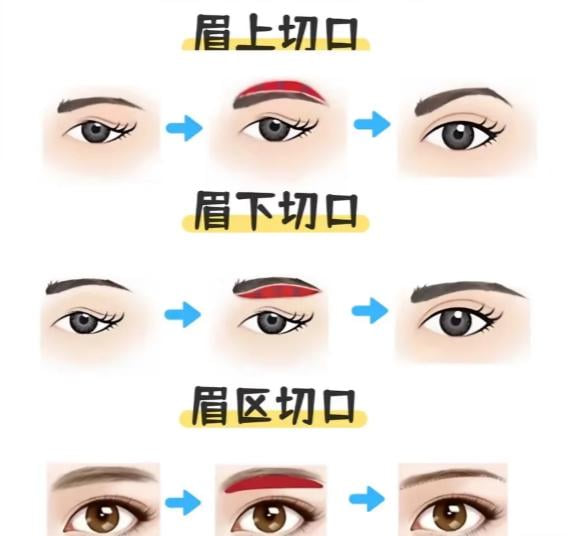 打算找郑大二附院正美李刚做提眉？真实价格与美卫士预约避坑指南提前查看