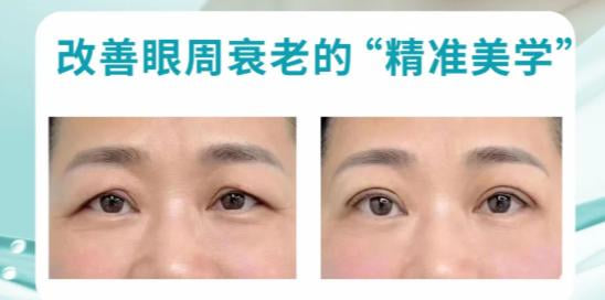 借助美卫士预约李刚医生，能拿到哪些实质性的靠谱优势？