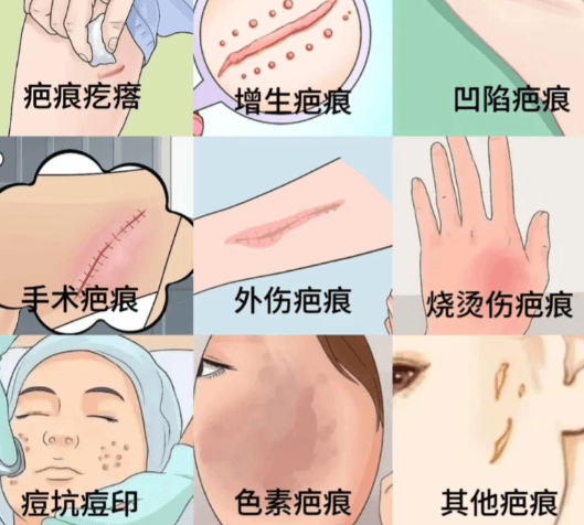 常见问题Q&Awww.51aimei.com