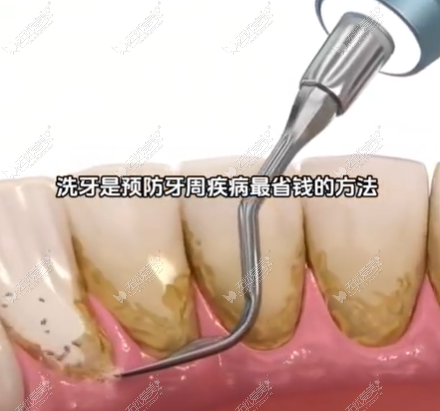 附近口腔洗牙预约 附近口腔洗牙预约
