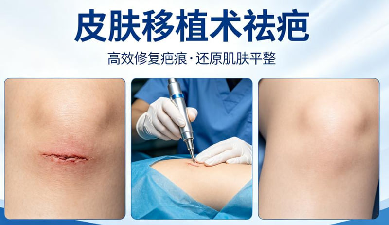 三、如何判断自己大概需要准备多少预算?