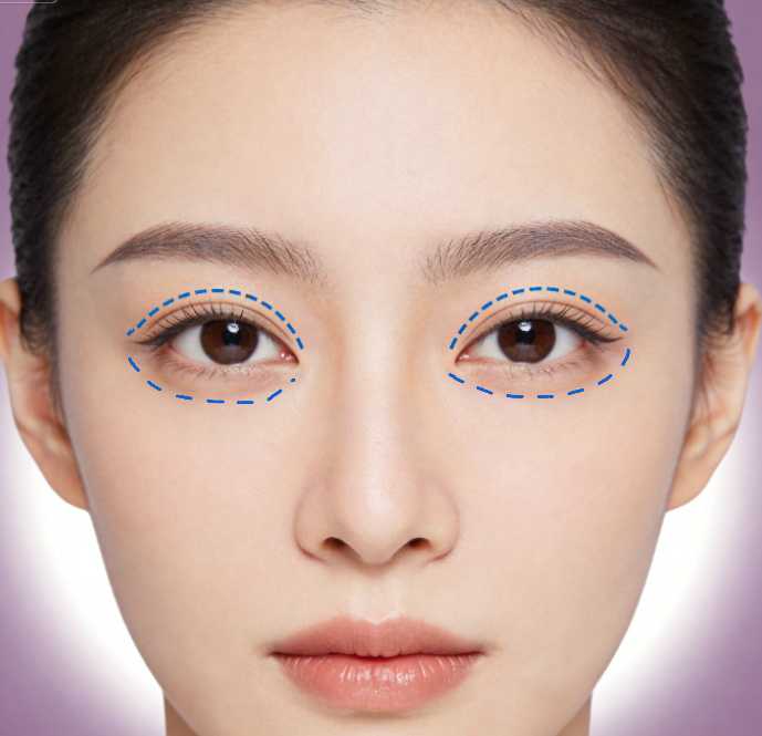 根据上海王衡健眼修复插图1