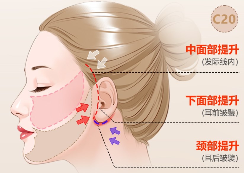 亲自摸底！北京华韩整形医院正规靠谱吗？主打高阶拉皮抗衰，资质和主刀医生我都上美卫士亲自核对过了！