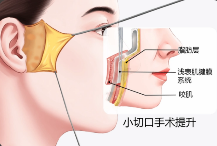 亲自摸底！北京华韩整形医院正规靠谱吗