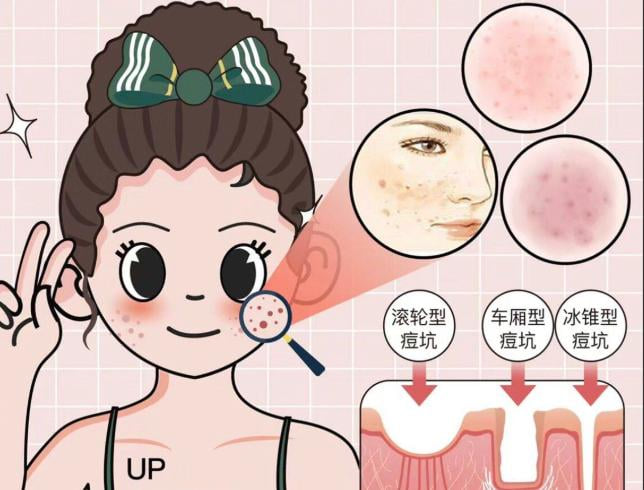 三、在哈尔滨,选择点阵激光医院还应对比哪些方面?