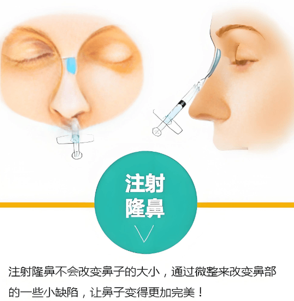 避坑指南：宝尼达注射的理性认知