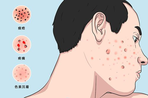 常见问题答疑（FAQ）