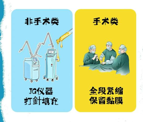 四、项目维度实操对比:不同需求到底怎么选?