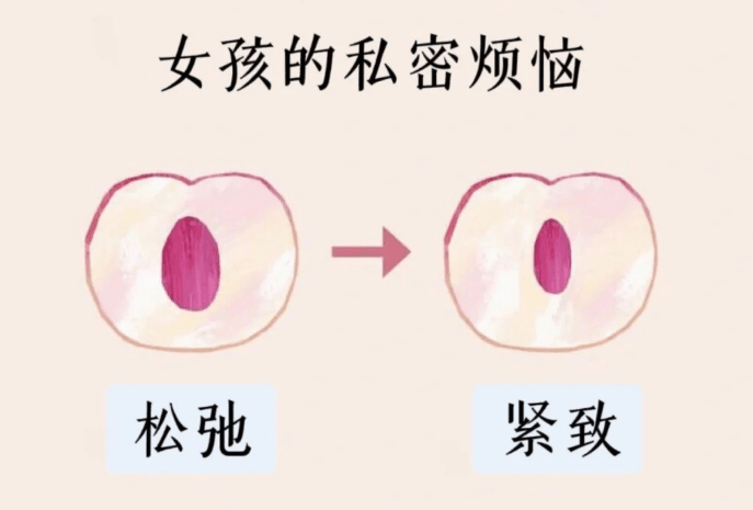 四、如何理性看待并对比私密整形价格