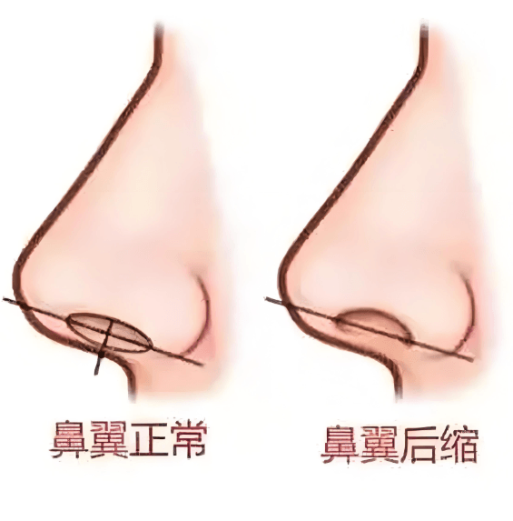 二、深入分析：长沙艺星整形医院在鼻部项目的整体实力