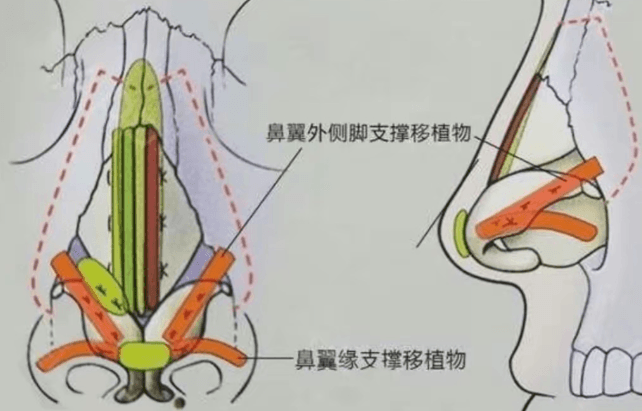 五、横向对比与较终选择建议