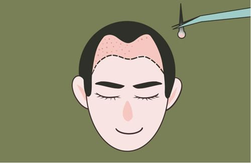 去亚韩面诊前,如何初步判断自己的大概费用